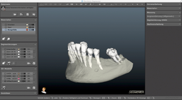 Lower Jaw Segmentation
