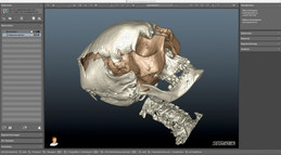 Segmentierung und Rekonstruktion einer Moorleiche