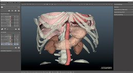 Segmentieren eines Abdomen
