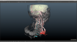 Volumendarstellung des Halses mit farbig markierten Strukturen