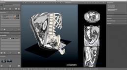 Hybride Volumendarstellung mit 3D-Modell und eingegrenztem 3D-Bereich